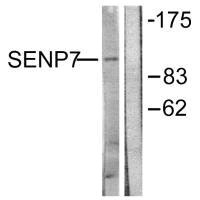 Western blot analysis of extracts from HuvEc cells, using SENP7 antibody. Western blot analysis of extracts from HuvEc cells, using SENP7 antibody.