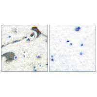 Immunohistochemical analysis of paraffin-embedded human brain tissue using RASH/RASK/RASN antibody.