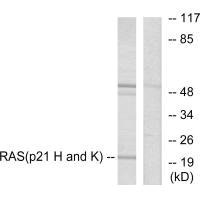 Western blot analysis of extracts from HeLa cells, using RASH/RASK/RASN antibody. Western blot analysis of extracts from HeLa cells, using RASH/RASK/RASN antibody.