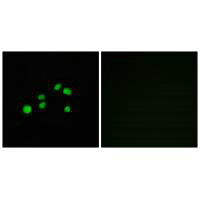 Immunofluorescence analysis of HepG2 cells, using Collagen XXIII alpha1 antibody. Immunofluorescence analysis of HepG2 cells, using Collagen XXIII alpha1 antibody.