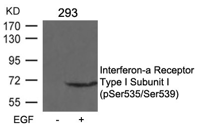 Western blot analysis of extracts from 293 cells untreated or treated with EGF using Interferon-a Receptor Type I Subunit I (phospho-Ser535/Ser539) Antibody. Western blot analysis of extracts from 293 cells untreated or treated with EGF using Interferon-a Receptor Type I Subunit I (phospho-Ser535/Ser539) Antibody.