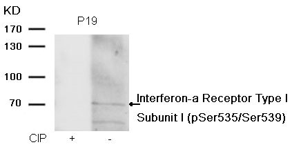 Western blot analysis of extracts from P19 cells, treated with calf intestinal phosphatase (CIP), using Interferon-a Receptor Type I Subunit I (phospho-Ser535/Ser539) Antibody.