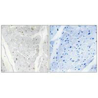 Immunohistochemistry analysis of paraffin-embedded human heart tissue, using ALPK2 antibody. Immunohistochemistry analysis of paraffin-embedded human heart tissue, using ALPK2 antibody.