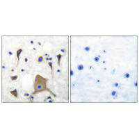 Immunohistochemical analysis of paraffin-embedded human brain tissue using GluR5 antibody. Immunohistochemical analysis of paraffin-embedded human brain tissue using GluR5 antibody.