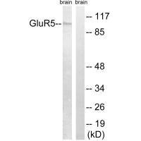 Western blot analysis of extracts from mouse brain, using GluR5 antibody.