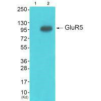 Western blot analysis of extracts from HepG2 cells (Lane 2), using GluR5 antiobdy. The lane on the left is treated with synthesized peptide.