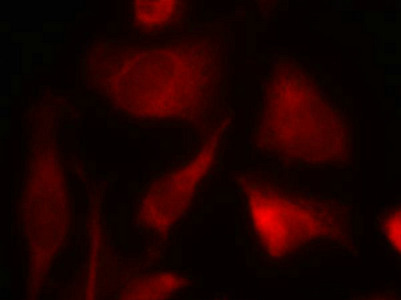 Immunofluorescence staining of methanol-fixed Hela cells using Smad2(Ab-467) Antibody.