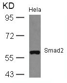 Western blot analysis of extracts from Hela cells using Smad2(Ab-467) Antibody. Western blot analysis of extracts from Hela cells using Smad2(Ab-467) Antibody.