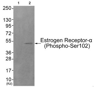Western blot analysis of extracts from HuvEc cells (Lane 2), using Estrogen Receptor-alpha (Phospho-Ser102) Antibody. The lane on the left is treated with antigen-specific peptide. Western blot analysis of extracts from HuvEc cells (Lane 2), using Estrogen Receptor-alpha (Phospho-Ser102) Antibody. The lane on the left is treated with antigen-specific peptide.