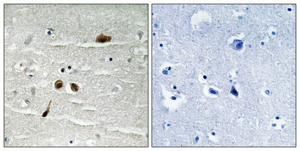 Immunohistochemical analysis of paraffin-embedded human brain tissue using MDC1 (Phospho-Ser513) antibody (left)or the same antibody preincubated with blocking peptide (right). Immunohistochemical analysis of paraffin-embedded human brain tissue using MDC1 (Phospho-Ser513) antibody (left)or the same antibody preincubated with blocking peptide (right).
