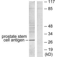 Western blot analysis of extracts from mouse prostate, using Prostate Stem Cell Antigen antibody. Western blot analysis of extracts from mouse prostate, using Prostate Stem Cell Antigen antibody.