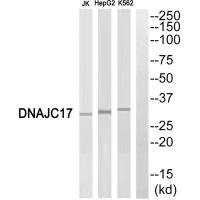 Western blot analysis of extracts from Jurkat cells, HepG2 cells and K562 cells, using DNAJC17 antibody. Western blot analysis of extracts from Jurkat cells, HepG2 cells and K562 cells, using DNAJC17 antibody.