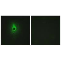 Immunofluorescence analysis of HeLa cells, using Collagen VI alpha3 antibody.
