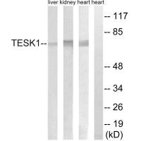 Western blot analysis of extracts from rat heart cells, rat kidney cells and rat liver cells, using TESK1 antibody. Western blot analysis of extracts from rat heart cells, rat kidney cells and rat liver cells, using TESK1 antibody.