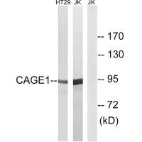 Western blot analysis of extracts from HT-29 cells and Jurkat cells, using CAGE1 antibody. Western blot analysis of extracts from HT-29 cells and Jurkat cells, using CAGE1 antibody.