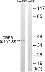 Western blot analysis of extracts from HUVEC cells, treated with etoposide (25uM, 24hours), using CREB (Phospho-Thr100) antibody. The lane on the right is treated with the synthesized peptide. Western blot analysis of extracts from HUVEC cells, treated with etoposide (25uM, 24hours), using CREB (Phospho-Thr100) antibody. The lane on the right is treated with the synthesized peptide.
