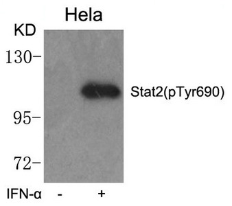 Western blot analysis of extracts from Hela cells untreated or treated with IFN-a using Stat2(phospho-Tyr690) Antibody. Western blot analysis of extracts from Hela cells untreated or treated with IFN-a using Stat2(phospho-Tyr690) Antibody.