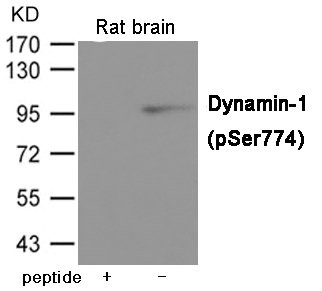 Western blot analysis of extracts from Rat brain tissue using Dynamin-1 (Phospho-Ser774) Antibody.The lane on the left is treated with the antigen-specific peptide. Western blot analysis of extracts from Rat brain tissue using Dynamin-1 (Phospho-Ser774) Antibody.The lane on the left is treated with the antigen-specific peptide.