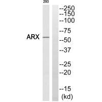 Western blot analysis of extracts from 293 cells, using ARX antibody. Western blot analysis of extracts from 293 cells, using ARX antibody.