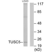 Western blot analysis of extracts from LOVO cells, using TUSC5 antibody. Western blot analysis of extracts from LOVO cells, using TUSC5 antibody.