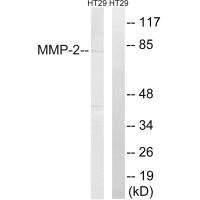 Western blot analysis of extracts from HT-29 cells, using MMP-2 antibody. Western blot analysis of extracts from HT-29 cells, using MMP-2 antibody.