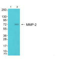 Western blot analysis of extracts from 3T3 cells (Lane 2), using MMP-2 antiobdy. The lane on the left is treated with synthesized peptide.