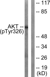 Western blot analysis of extracts from mouse liver cells, using Akt (Phospho-Tyr326) antibody. The lane on the right is treated with the synthesized peptide. Western blot analysis of extracts from mouse liver cells, using Akt (Phospho-Tyr326) antibody. The lane on the right is treated with the synthesized peptide.