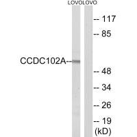 Western blot analysis of extracts from LOVO cells, using CCDC102A antibody. Western blot analysis of extracts from LOVO cells, using CCDC102A antibody.