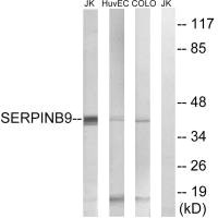 Western blot analysis of extracts from Jurkat cells, using SERPINB9 antibody. Western blot analysis of extracts from Jurkat cells, using SERPINB9 antibody.