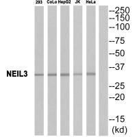 Western blot analysis of extracts from COLO cells, HUVEC cells, HepG2 cells and HeLa cells, using NEIL3 antibody. Western blot analysis of extracts from COLO cells, HUVEC cells, HepG2 cells and HeLa cells, using NEIL3 antibody.
