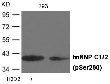 Western blot analysis of extracts from 293 cells untreated or treated with H2O2 using hnRNP C1/2 (Phospho-Ser260) Antibody . Western blot analysis of extracts from 293 cells untreated or treated with H2O2 using hnRNP C1/2 (Phospho-Ser260) Antibody .