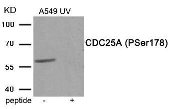 Western blot analysis of extracts from A549 cells treated with UV using Phospho-CDC25A (Ser178) antibody.The lane on the right is treated with the antigen-specific peptide. Western blot analysis of extracts from A549 cells treated with UV using Phospho-CDC25A (Ser178) antibody.The lane on the right is treated with the antigen-specific peptide.