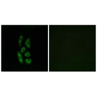 Immunofluorescence analysis of A549 cells, using ACOT12 antibody.