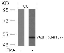 Western blot analysis of extracts from C6 cells untreated or treated with PMA using VASP(Phospho-Ser157) Antibody. Western blot analysis of extracts from C6 cells untreated or treated with PMA using VASP(Phospho-Ser157) Antibody.