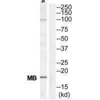 Western blot analysis of extracts from Jurkat cells, using MB antibody. Western blot analysis of extracts from Jurkat cells, using MB antibody.