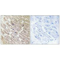 Immunohistochemistry analysis of paraffin-embedded human heart tissue using MRPL16 antibody.