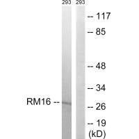 Western blot analysis of extracts from 293 cells, using MRPL16 antibody. Western blot analysis of extracts from 293 cells, using MRPL16 antibody.