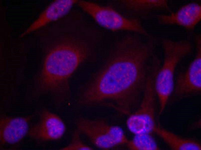 Immunofluorescence staining of methanol-fixed Hela cells using JNK1/JNK2/JNK3(phospho-Thr183/Tyr185) Antibody.