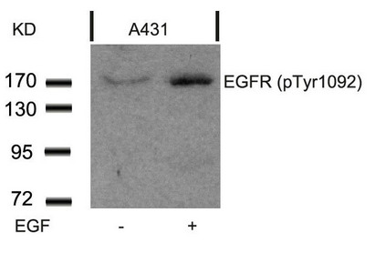 Western blot analysis of extracts from A431 cells untreated or treated with EGF using EGFR(Phospho-Tyr1092) Antibody. Western blot analysis of extracts from A431 cells untreated or treated with EGF using EGFR(Phospho-Tyr1092) Antibody.