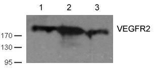 Western blot analysis of cell lysates using VEGFR2(Ab-1059) antibody Lane 1 and 2: Huvec cell; Lane 3 HT29 cell) Western blot analysis of cell lysates using VEGFR2(Ab-1059) antibody Lane 1 and 2: Huvec cell; Lane 3 HT29 cell)