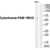 Western blot analysis of extracts from COLO205 cells, using Cytochrome P450 11B1/2 antibody. Western blot analysis of extracts from COLO205 cells, using Cytochrome P450 11B1/2 antibody.