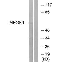 Western blot analysis of extracts from COLO cells, using MEGF9 antibody. Western blot analysis of extracts from COLO cells, using MEGF9 antibody.