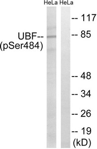 Western blot analysis of extracts from HeLa cells, treated with calyculinA (50ng/ml, 30mins), using UBF (Phospho-Ser484) antibody. The lane on the right is treated with the synthesized peptide. Western blot analysis of extracts from HeLa cells, treated with calyculinA (50ng/ml, 30mins), using UBF (Phospho-Ser484) antibody. The lane on the right is treated with the synthesized peptide.