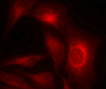Immunofluorescence staining of methanol-fixed Hela cells showing cytoplasmic staining using HSP27(Phospho-Ser15) Antibody.