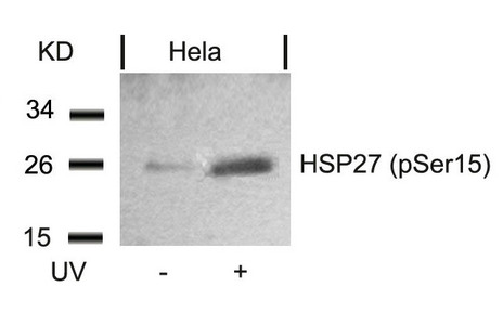 Western blot analysis of extracts from Hela cells untreated or treated with UV using HSP27(Phospho-Ser15) Antibody. Western blot analysis of extracts from Hela cells untreated or treated with UV using HSP27(Phospho-Ser15) Antibody.