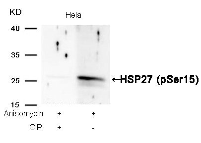 Western blot analysis of extracts from Hela cells, treated with Anisomycin or calf intestinal phosphatase (CIP), using HSP27 (Phospho-Ser15) Antibody.