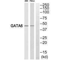 Western blot analysis of extracts from 293 cells and HeLa cells, using GATA6 antibody. Western blot analysis of extracts from 293 cells and HeLa cells, using GATA6 antibody.
