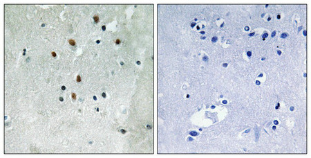 Immunohistochemistry analysis of paraffin-embedded human brain tissue using SRF (Phospho-Ser77) antibody. The picture on the right is treated with the synthesized peptide.