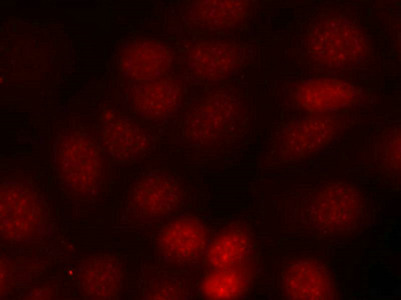 Immunofluorescence staining of methanol-fixed MCF cells using p70 S6 Kinase(Phospho-Thr421) Antibody.
