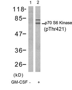 Western blot analysis of extracts from Jurkat cells untreated(lane 1) or treated with GM-CSF(lane 2) using p70 S6 Kinase(Phospho-Thr421) Antibody. Western blot analysis of extracts from Jurkat cells untreated(lane 1) or treated with GM-CSF(lane 2) using p70 S6 Kinase(Phospho-Thr421) Antibody.